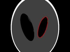 Result Image of Segmentation