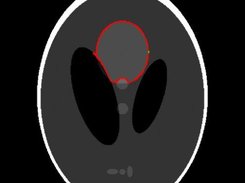 Result Image of Segmentation 2