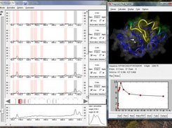 RAVE screencap in limited proteolysis mode