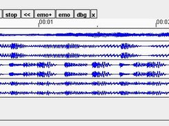 Principle of operation - summation of sound lines