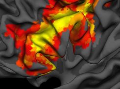 SPM surfrend rendering (smoothwm surface w/PFC zoom)