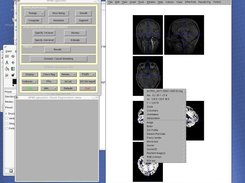 Context menu in CheckReg (spm_orthviews) with plugins