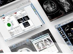 Suitestensa CVIS PACS Screenshot 1