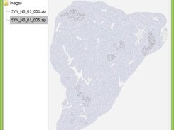 Synthetic WSI (CD8)