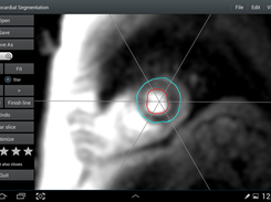 Segmentation