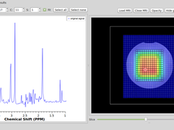 MRSI visualisation