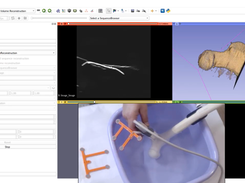 3D Slicer Screenshot 1