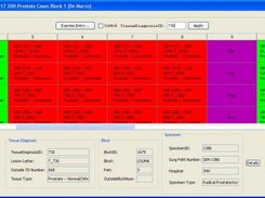 Designing an Array-Block in TMAJ