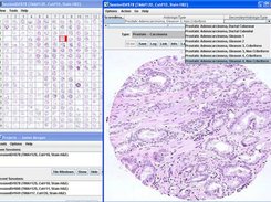 Viewing an image in a tissue microarray slide