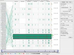 TNV overview