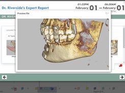 TrialLine Case Timeline Software