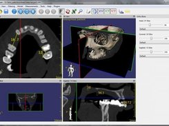 Multiplanar visualization and measurements