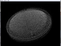 3D ultrasonic data