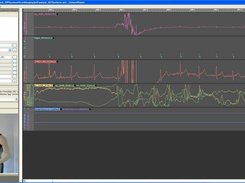 Screenshot of UnisensViewer showing a Unisens data set