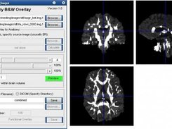 Example of diffusion imaging application: FA Map