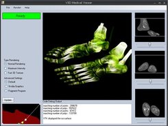 dicom feet file color volume rendered