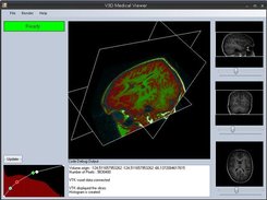 Colored plane view of MR head data