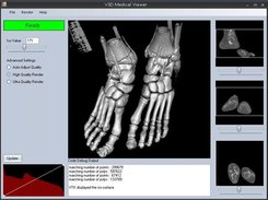 dicom feet file rendered with Marching Cubes