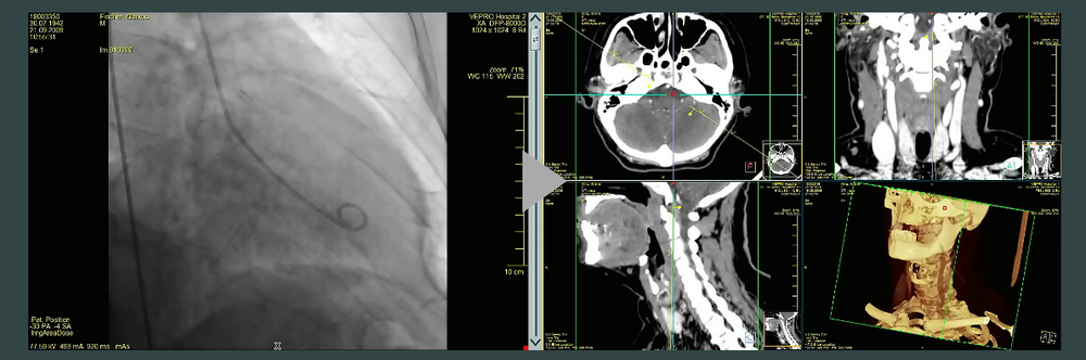 VEPRO PACS/EMR Screenshot 1