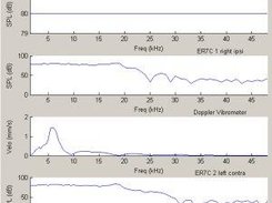 Amplitude spectra of measured results.