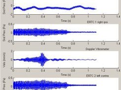 Oscillograms of raw results.