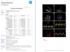 ViewPoint 6 Screenshot 1