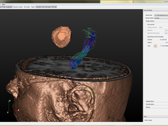 Volume rendering of T1-weighted MRI with clipping planes