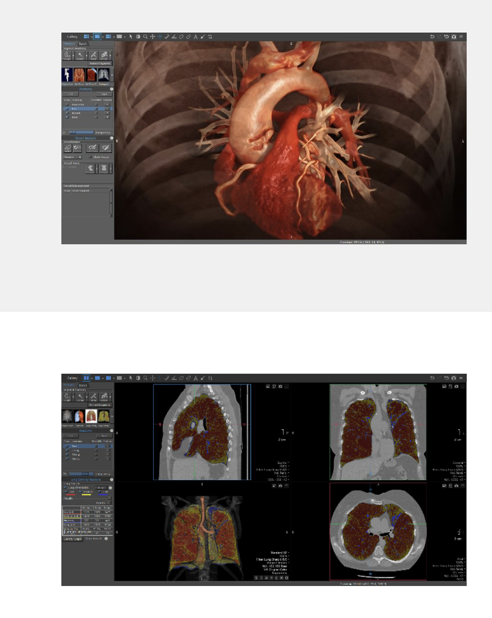 Vitrea Screenshot 1
