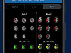 Viz.ai Screenshot 1
