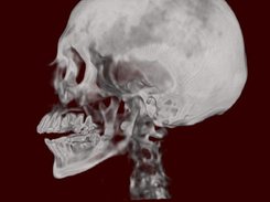 VolCast GPU-based volume rendering Screenshot 4