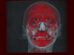 VolCast GPU-based volume rendering Screenshot 1