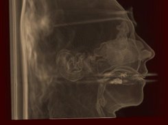 VolCast GPU-based volume rendering Screenshot 2