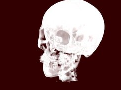 VolCast GPU-based volume rendering Screenshot 3