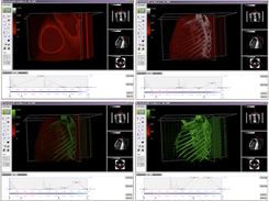 VolumStudio3d Screenshot 2