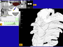VolumStudio3d Screenshot 3