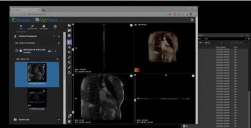 VolView Screenshot 1