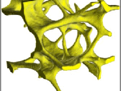 Trabecular Bone