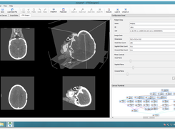 Inbuilt DICOM DataFileLoaders loads and entire series and offers MPR visualization