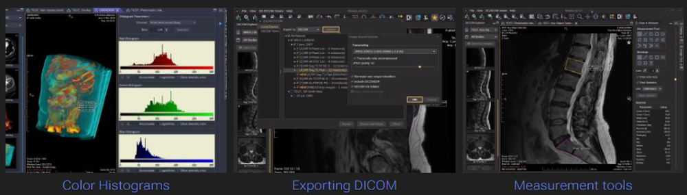 Weasis Screenshot 1