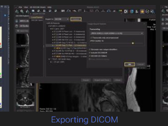Weasis Screenshot 1