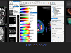 Weasis Screenshot 2
