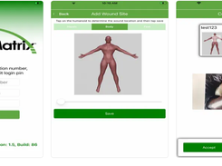 WoundMatrix Screenshot 1