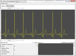 Online signal viewer