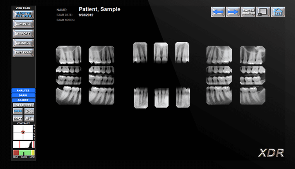 XDR Dental Imaging Screenshot 1