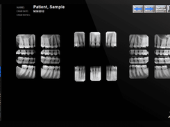 XDR Dental Imaging Screenshot 1