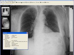 Chest X-Ray and Study Info Dialog