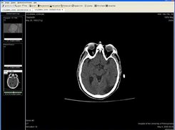 CT of the Head